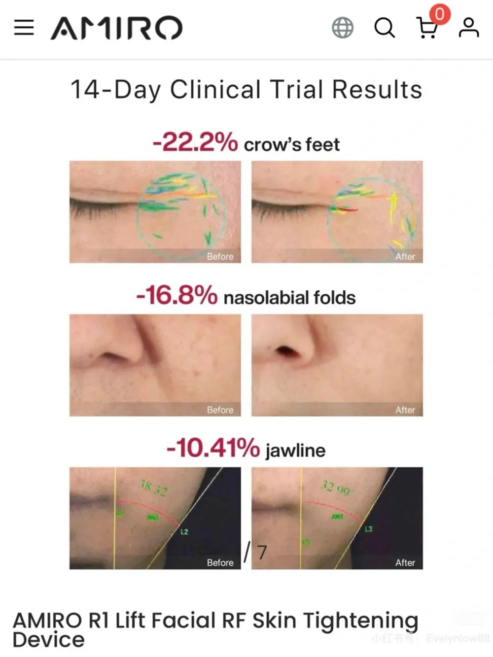AMIRO R1 Pro RF Facial Device - Picture 4 of 5